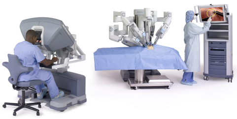 ロボット支援前立腺全摘除術