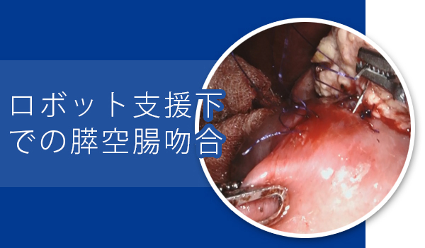 図２：膵臓と腸の吻合