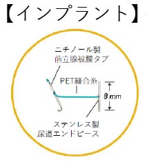 ウロリフト