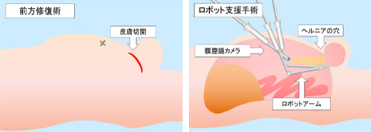 手術