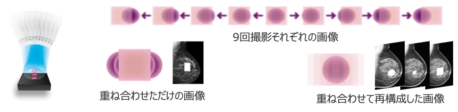 3Dマンモグラフィ(トモシンセシス)の撮影。より詳細で精度の高い情報を得ることができます。